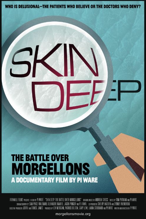 Skin Deep: The Battle Over Morgellons